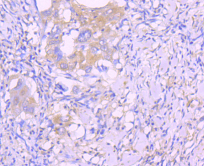 Caspase 8 Antibody in Immunohistochemistry (Paraffin) (IHC (P))