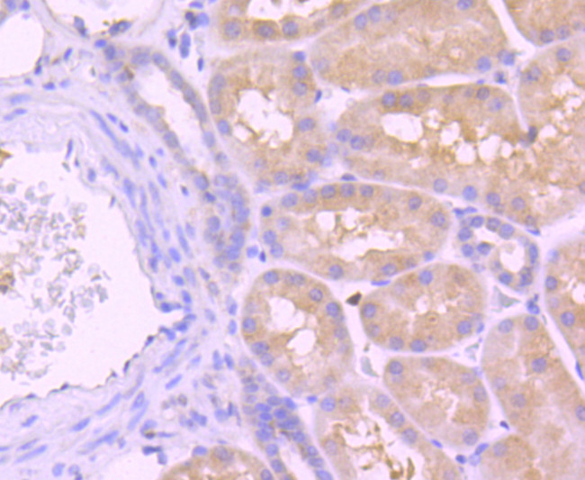 Caspase 8 Antibody in Immunohistochemistry (Paraffin) (IHC (P))