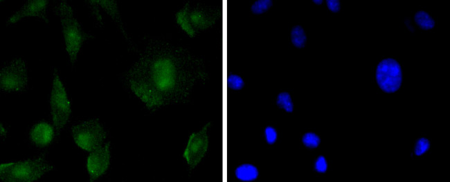 SOX11 Antibody in Immunocytochemistry (ICC/IF)