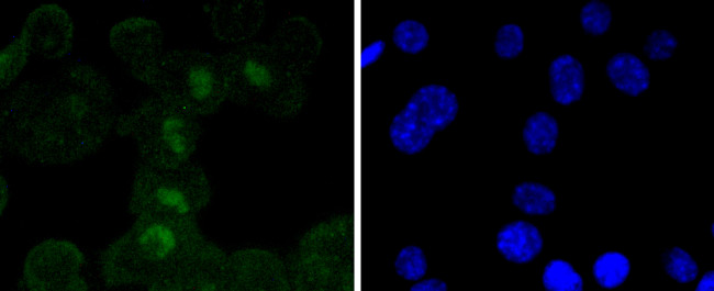 SOX11 Antibody in Immunocytochemistry (ICC/IF)