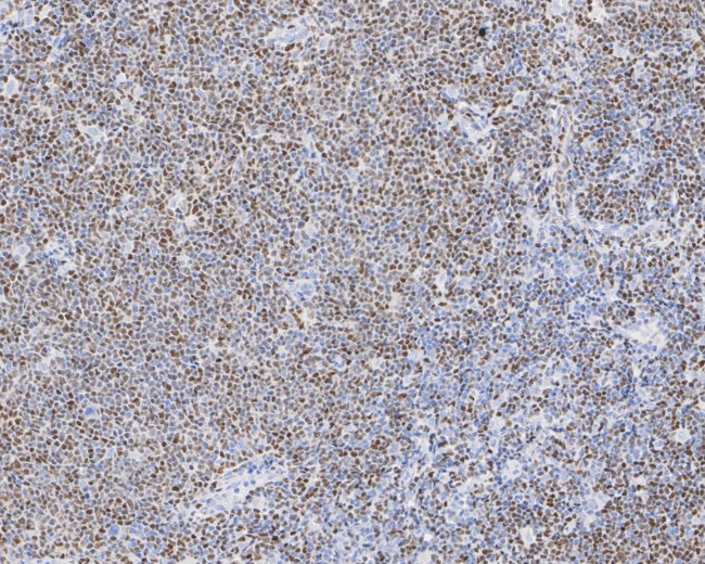 SOX11 Antibody in Immunohistochemistry (Paraffin) (IHC (P))