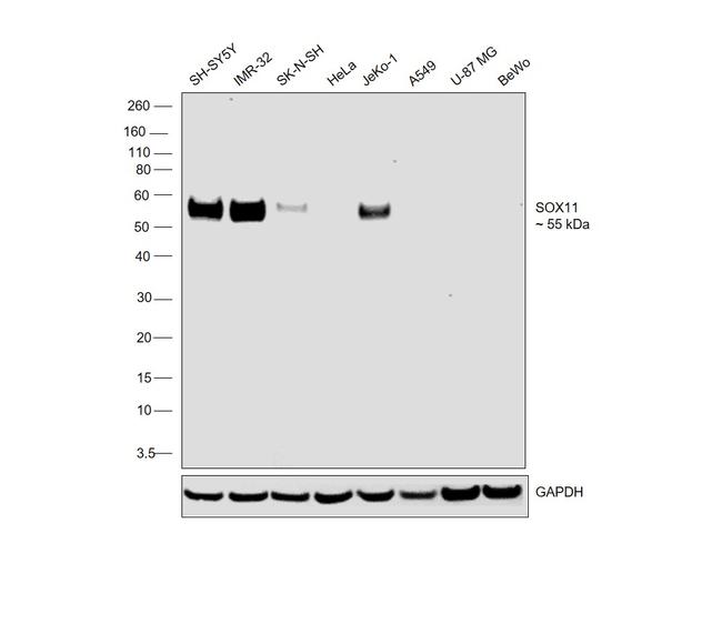 SOX11 Antibody in Western Blot (WB)