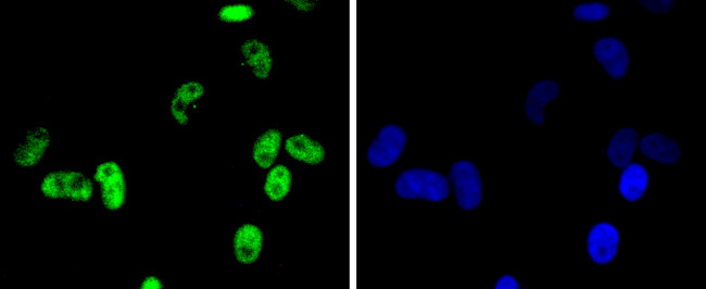 CDK9 Antibody in Immunocytochemistry (ICC/IF)