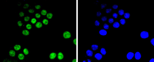 CDK9 Antibody in Immunocytochemistry (ICC/IF)