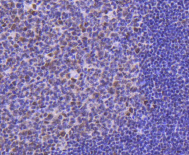 CDK9 Antibody in Immunohistochemistry (Paraffin) (IHC (P))