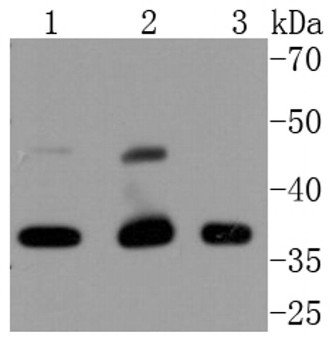 CDK9 Antibody in Western Blot (WB)