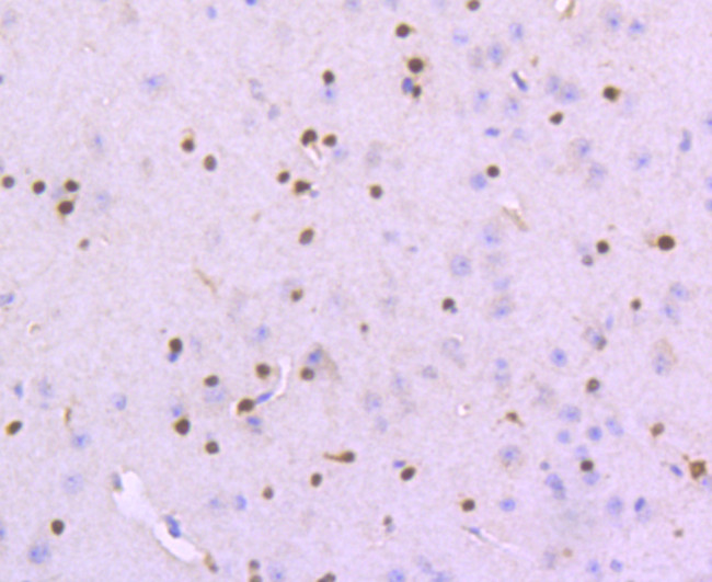 SOX10 Antibody in Immunohistochemistry (Paraffin) (IHC (P))