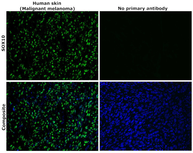 SOX10 Antibody in Immunohistochemistry (Paraffin) (IHC (P))