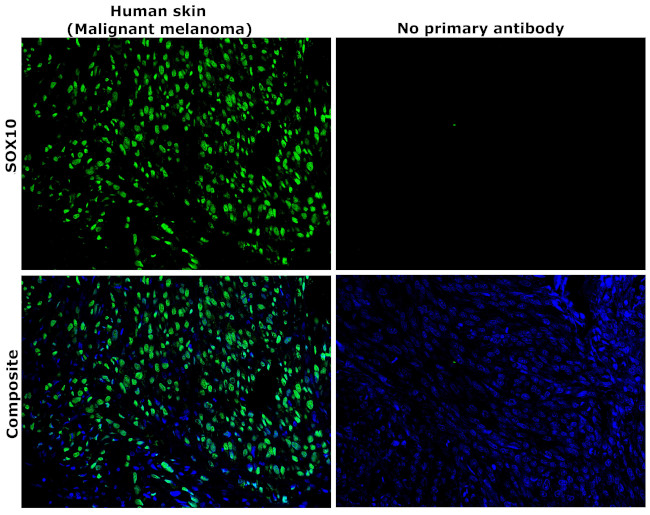 SOX10 Antibody in Immunohistochemistry (Paraffin) (IHC (P))