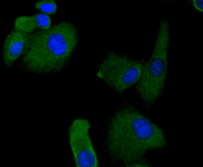 RON Antibody in Immunocytochemistry (ICC/IF)