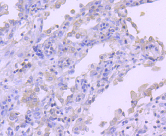 RON Antibody in Immunohistochemistry (Paraffin) (IHC (P))