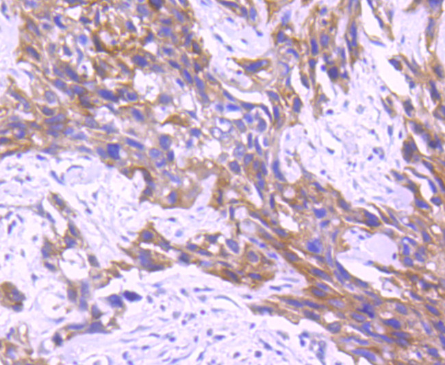 RON Antibody in Immunohistochemistry (Paraffin) (IHC (P))