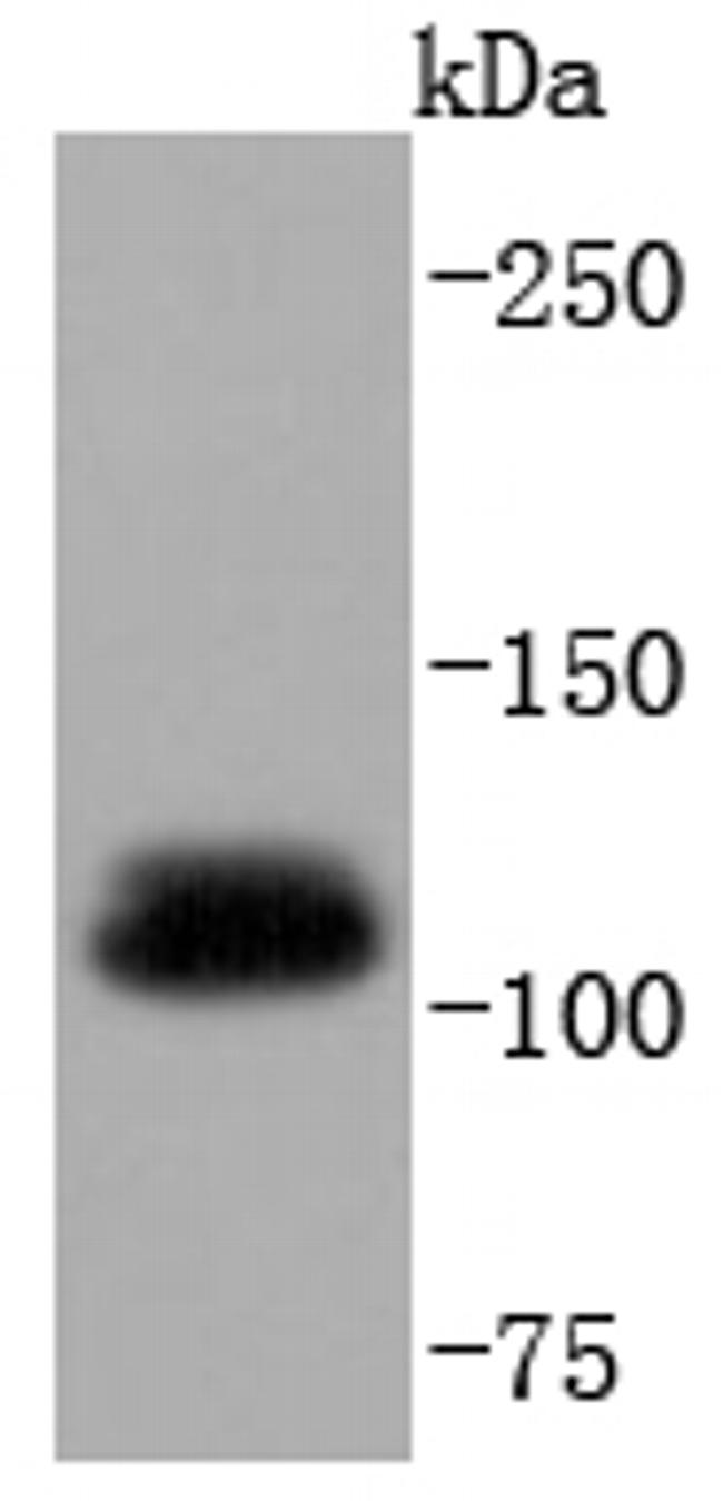 UBE1 Antibody in Western Blot (WB)