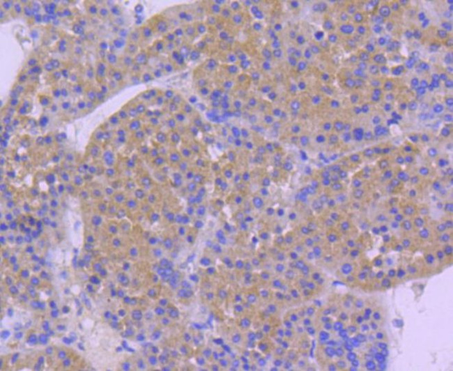 HSP105 Antibody in Immunohistochemistry (Paraffin) (IHC (P))