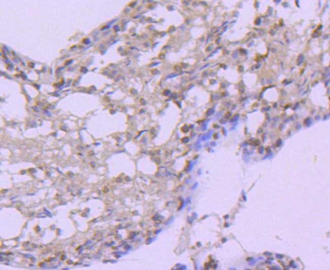 HSP105 Antibody in Immunohistochemistry (Paraffin) (IHC (P))