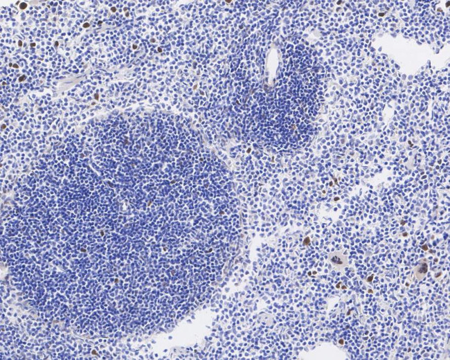 Phospho-Cdc6 (Ser54) Antibody in Immunohistochemistry (Paraffin) (IHC (P))