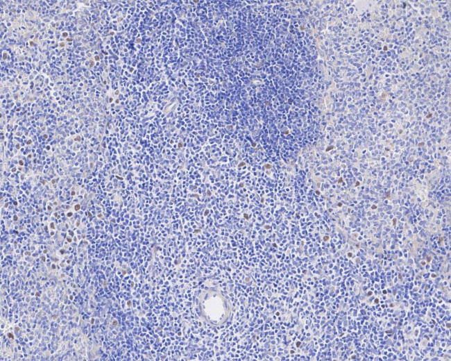 Phospho-Cdc6 (Ser54) Antibody in Immunohistochemistry (Paraffin) (IHC (P))