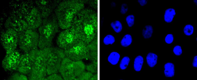 Phospho-Cdc6 (Ser54) Antibody in Immunocytochemistry (ICC/IF)