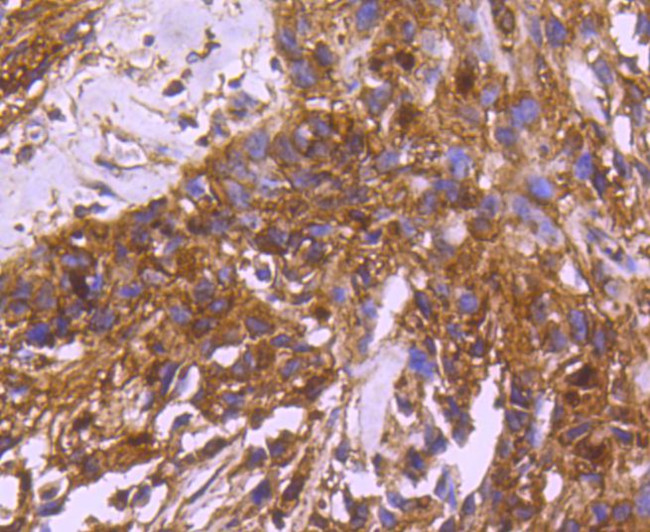 14-3-3 beta Antibody in Immunohistochemistry (Paraffin) (IHC (P))