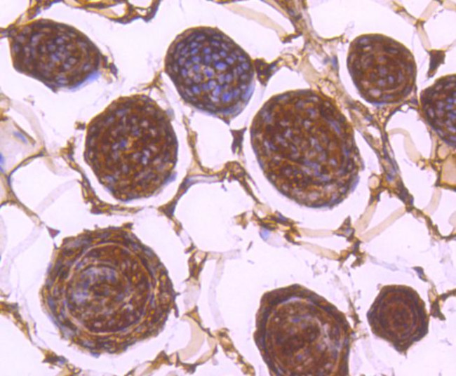 14-3-3 beta Antibody in Immunohistochemistry (Paraffin) (IHC (P))