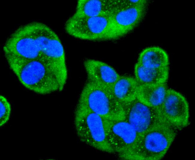 Cdc34 Antibody in Immunocytochemistry (ICC/IF)