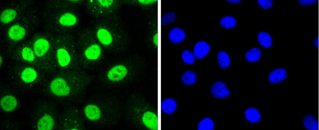 HDAC8 Antibody in Immunocytochemistry (ICC/IF)