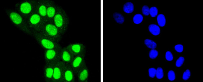 HDAC8 Antibody in Immunocytochemistry (ICC/IF)