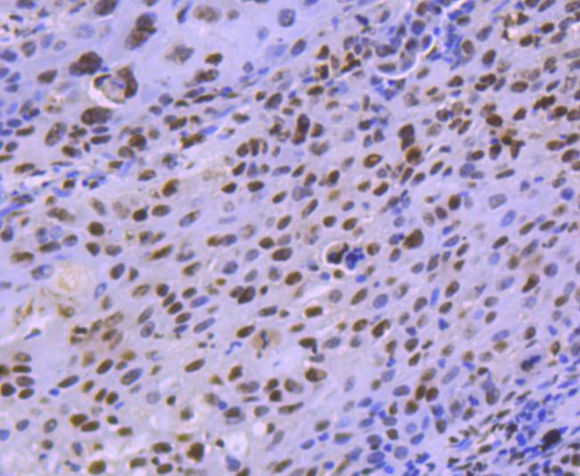 HDAC8 Antibody in Immunohistochemistry (Paraffin) (IHC (P))