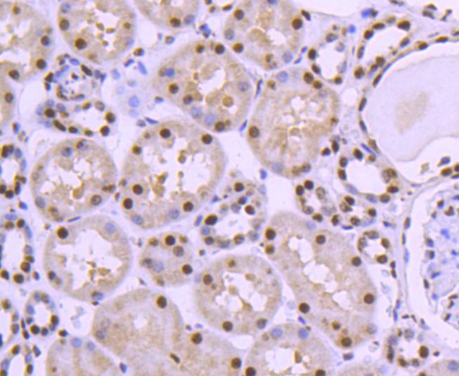 HDAC8 Antibody in Immunohistochemistry (Paraffin) (IHC (P))