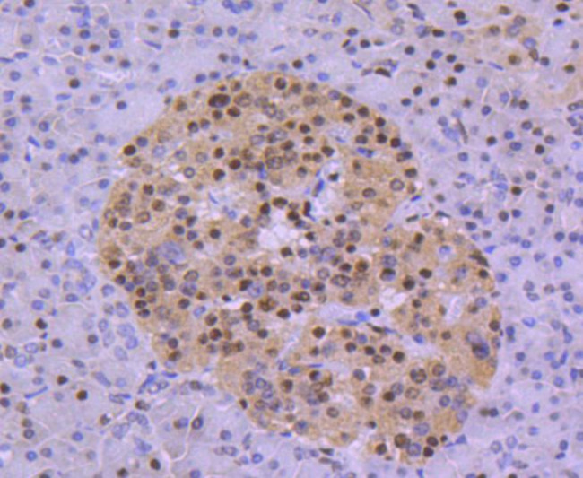 HDAC8 Antibody in Immunohistochemistry (Paraffin) (IHC (P))