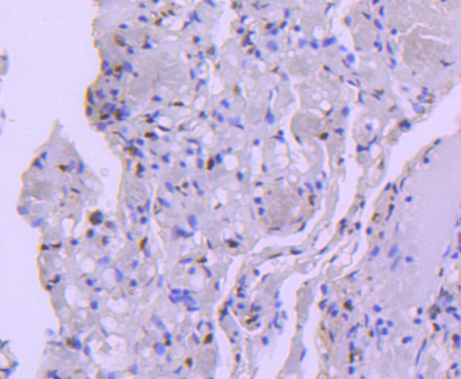 HDAC8 Antibody in Immunohistochemistry (Paraffin) (IHC (P))