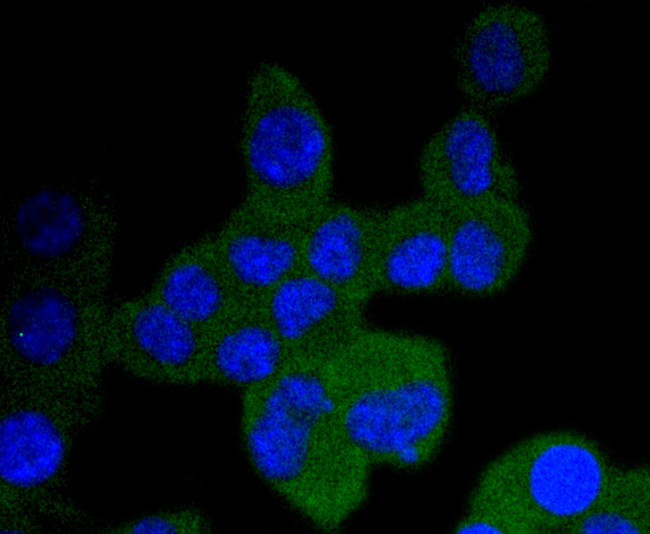 TrkA/TrkB/TrkC Antibody in Immunocytochemistry (ICC/IF)