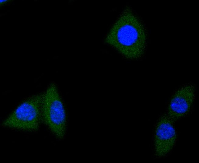 TrkA/TrkB/TrkC Antibody in Immunocytochemistry (ICC/IF)