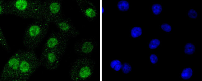 SUMO2/SUMO3 Antibody in Immunocytochemistry (ICC/IF)