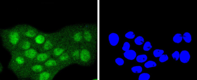 SUMO2/SUMO3 Antibody in Immunocytochemistry (ICC/IF)