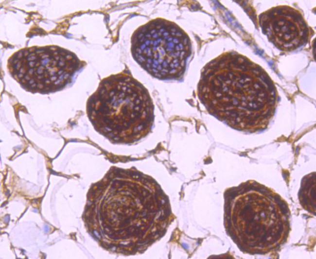 14-3-3 beta/zeta Antibody in Immunohistochemistry (Paraffin) (IHC (P))