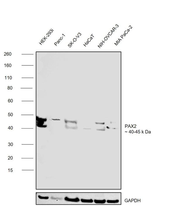 PAX2 Antibody in Western Blot (WB)