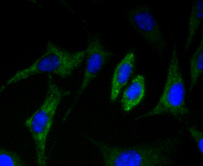 CD36 Antibody in Immunocytochemistry (ICC/IF)