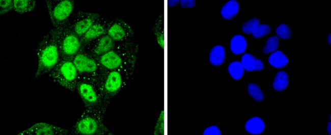 CDK7 Antibody in Immunocytochemistry (ICC/IF)