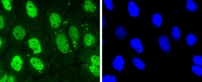 CDK7 Antibody in Immunocytochemistry (ICC/IF)