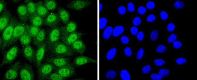 CDK7 Antibody in Immunocytochemistry (ICC/IF)