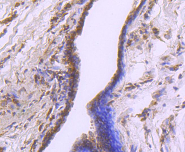 CDK7 Antibody in Immunohistochemistry (Paraffin) (IHC (P))