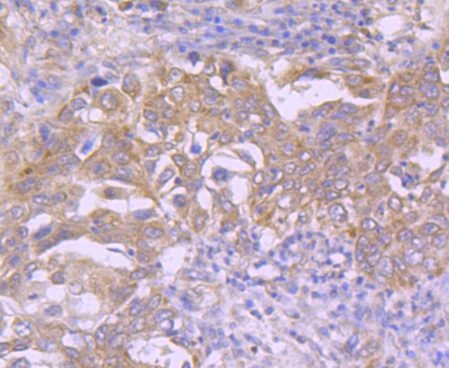 CDK7 Antibody in Immunohistochemistry (Paraffin) (IHC (P))