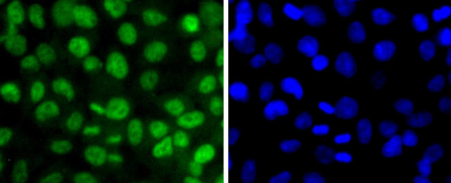 Phospho-SIRT1 (Thr530) Antibody in Immunocytochemistry (ICC/IF)