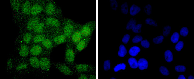 SIRT6 Antibody in Immunocytochemistry (ICC/IF)