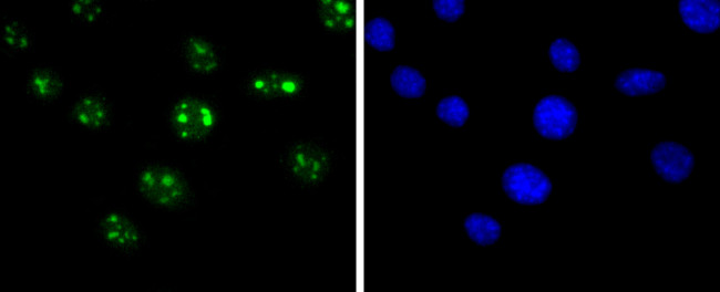 SIRT6 Antibody in Immunocytochemistry (ICC/IF)