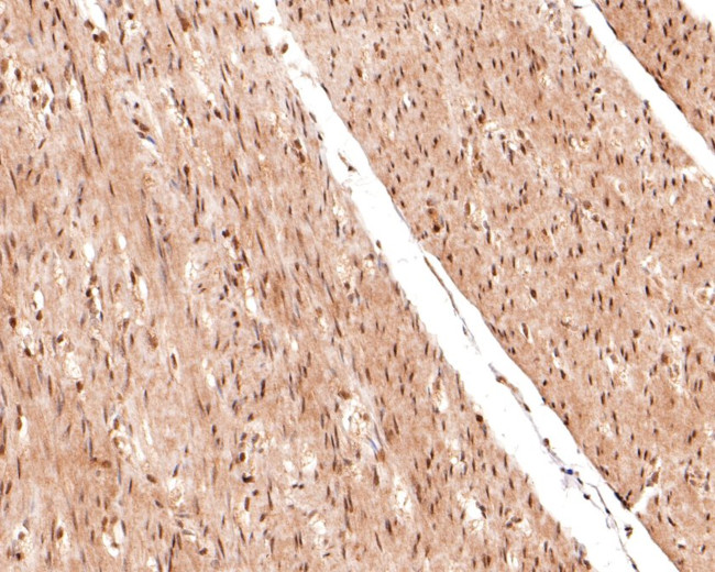 Phospho-c-Raf (Ser621) Antibody in Immunohistochemistry (Paraffin) (IHC (P))