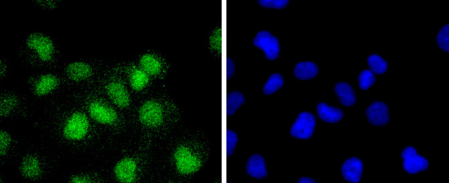 ATF1 Antibody in Immunocytochemistry (ICC/IF)