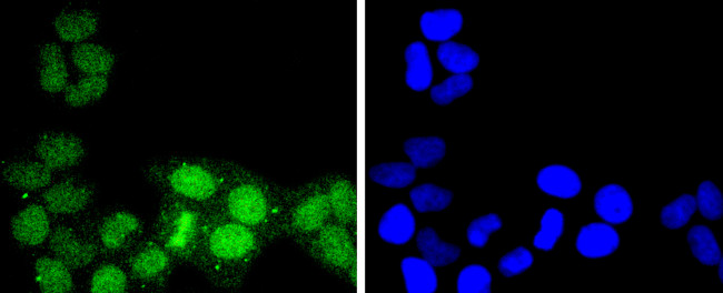 ATF1 Antibody in Immunocytochemistry (ICC/IF)