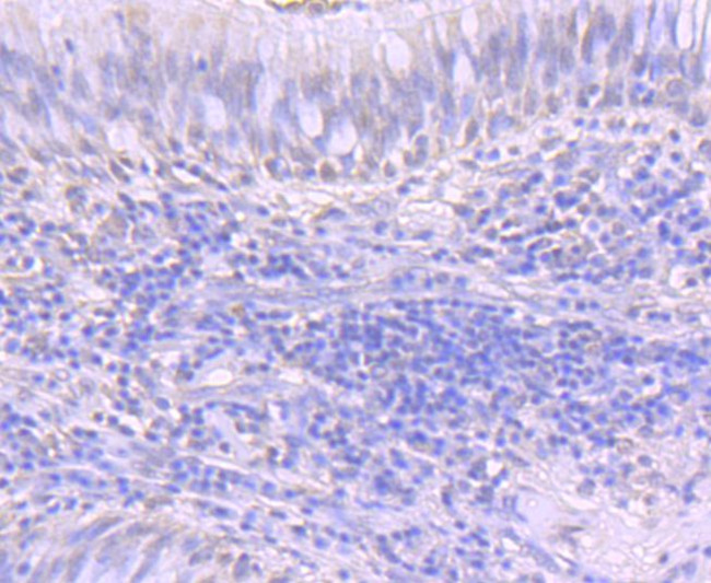 ATF1 Antibody in Immunohistochemistry (Paraffin) (IHC (P))